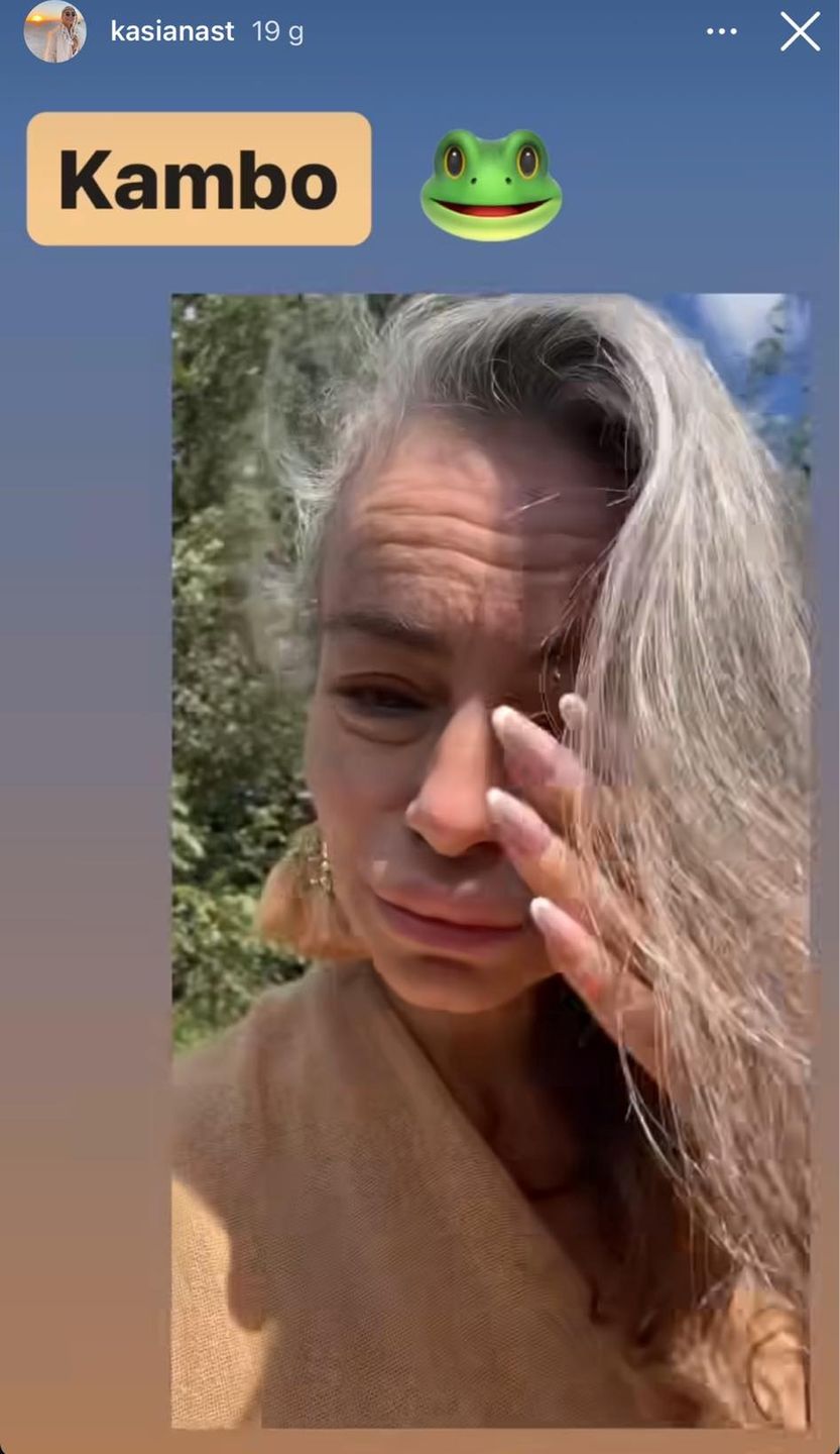 Kasia Nast wstrzyknęła sobie jad żaby