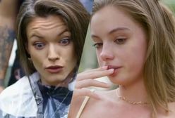 Wstrząsająca diagnoza jednej z "Top Modelek". Włosy miały to zakrywać