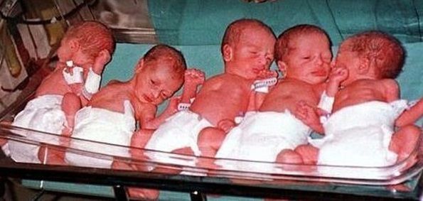 Pięcioraczki po urodzeniu