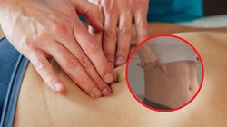 Może prowadzić do choroby żelaznych żył. "Najczęściej atakuje młode kobiety"