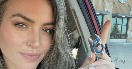 Zaczęła siwieć jako 16-latka. "Słyszałam, że jestem brzydka"