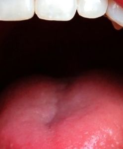 Egipcjanie u nas na wycieczce do... dentysty