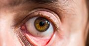 Każdy z nas ma małą dziurkę w powiece. Do czego ona służy?