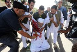 Libia: 22 zabitych i 130 rannych w starciach na północy kraju