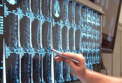 Szpitale mają sposób jak zaoszczędzić pieniądze