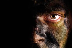 Pomisyjne traumy żołnierzy - rany krwawiące do wewnątrz