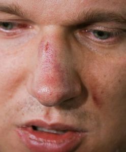 Łukasz Warzecha: sprawa Przemysława Wiplera jest przykra z paru powodów