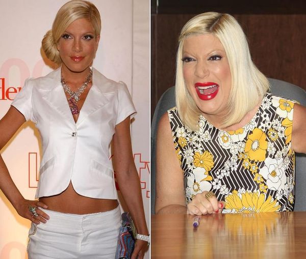 Tori Spelling: Jej twarz ewoluuje!