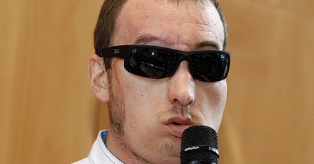 Pierwszy wywiad mężczyzny z przeszczepioną twarzą: modliłem się za dawcę