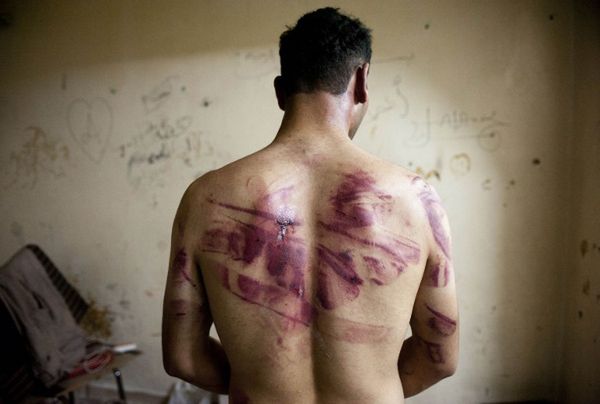 HRW ma dowody na tortury w syryjskich więzieniach