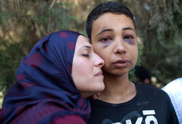 Izraelska policja brutalnie pobiła 15-latka. Przyleciał z USA odwiedzić rodzinę w Palestynie