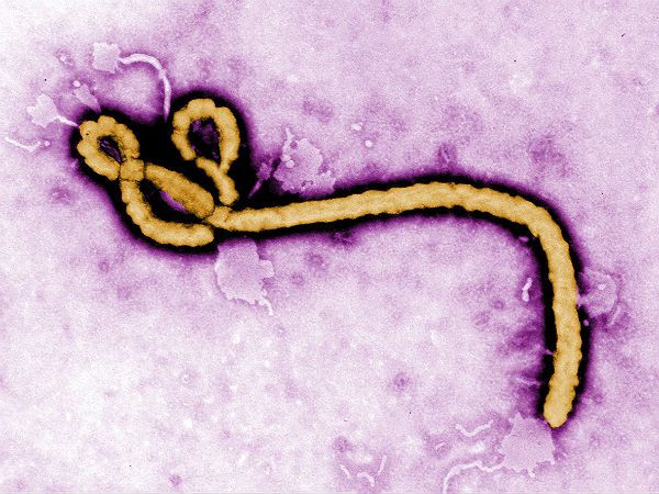 Wirus Ebola może przenosić się między gatunkami bez bezpośredniego kontaktu