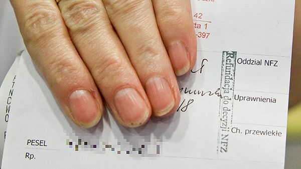 Farmaceutka prezentuje receptę z pieczątką "refundacja do decyzji NFZ"