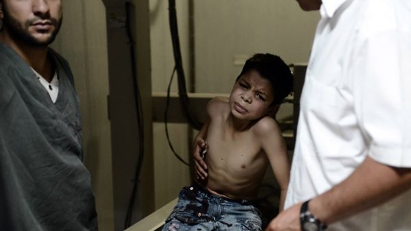 Chłopiec ranny podczas nalotu Aleppo