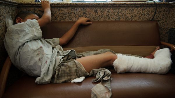 Chłopiec ranny podczas ostrzału Aleppo