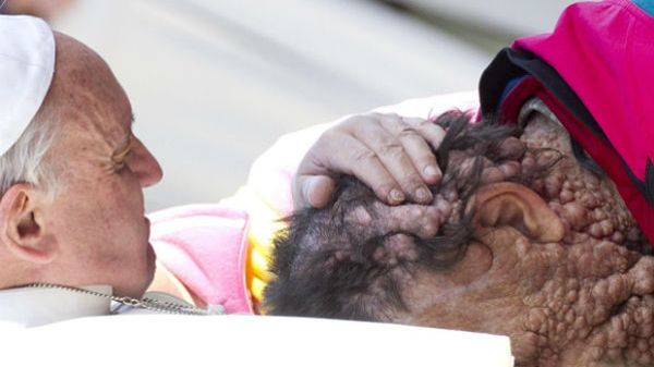 Papież Franciszek ucałował twarz chorego mężczyzny i pobłogosławił go