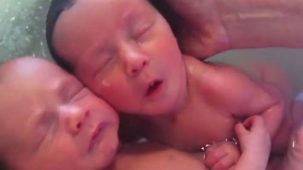 Inne dzieci, które obejmowały się po narodzinach