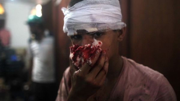 Chłopiec ranny podczas starć w Kairze