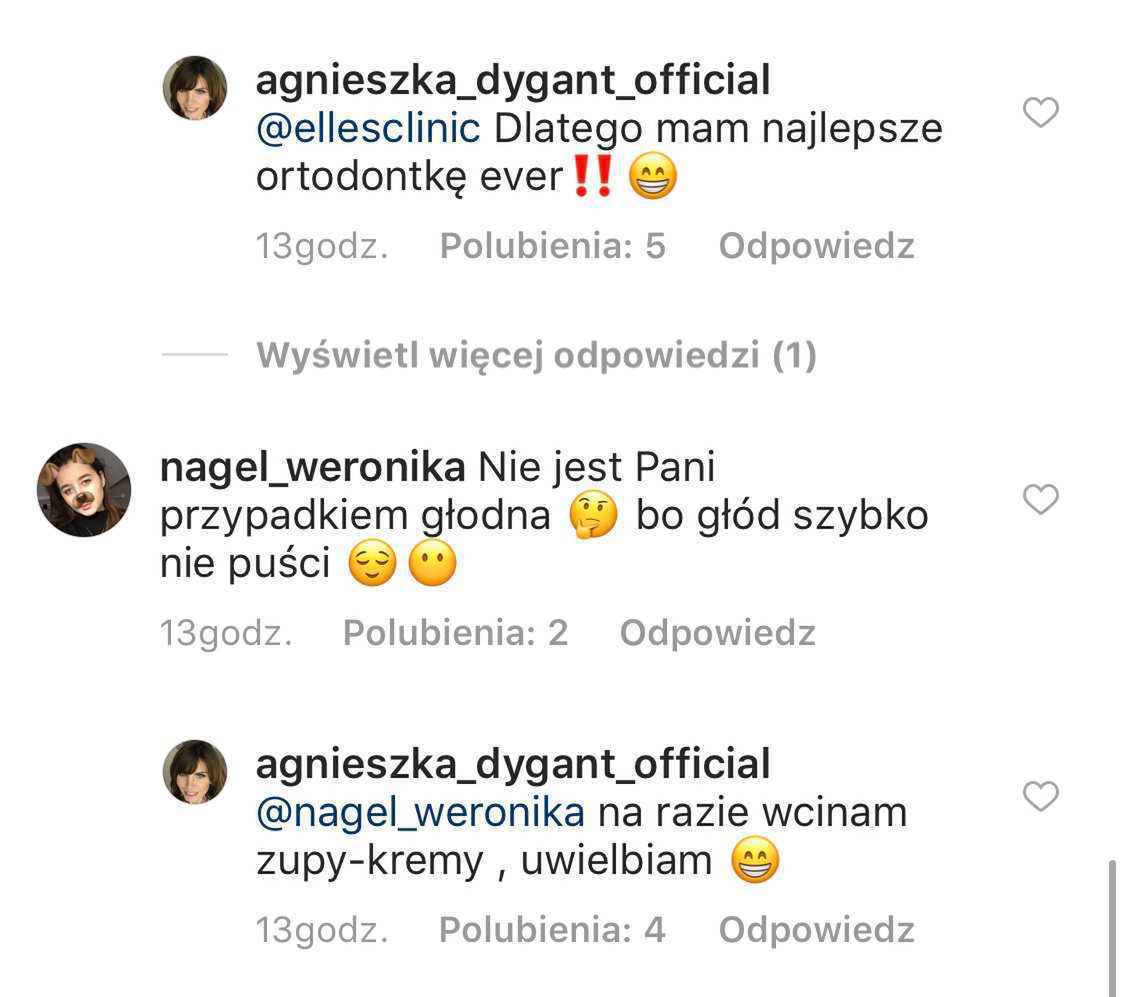 Agnieszka Dygant założyła aparat na zęby