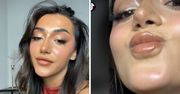 Pokazała skutek powiększania ust. Internauci oburzeni: "Przestań przekonywać młode kobiety, by się na to decydowały"