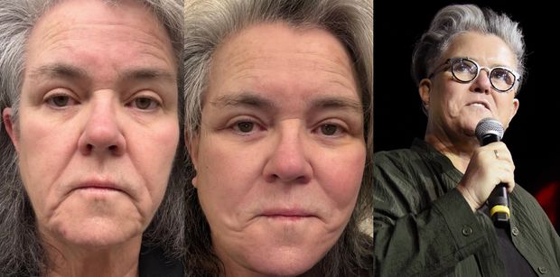 Z rzeczy ważnych: Rosie O'Donnell zrobiła sobie LIFTING TWARZY. Martwiła się, że to "zdrada feminizmu", ale już jej przeszło: "Przed i po"