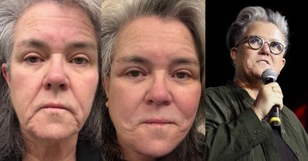 Z rzeczy ważnych: Rosie O'Donnell zrobiła sobie LIFTING TWARZY. Martwiła się, że to "zdrada feminizmu", ale już jej przeszło: "Przed i po"