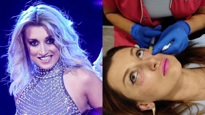 Justyna Żyła relacjonuje wizytę w klinice medycyny estetycznej