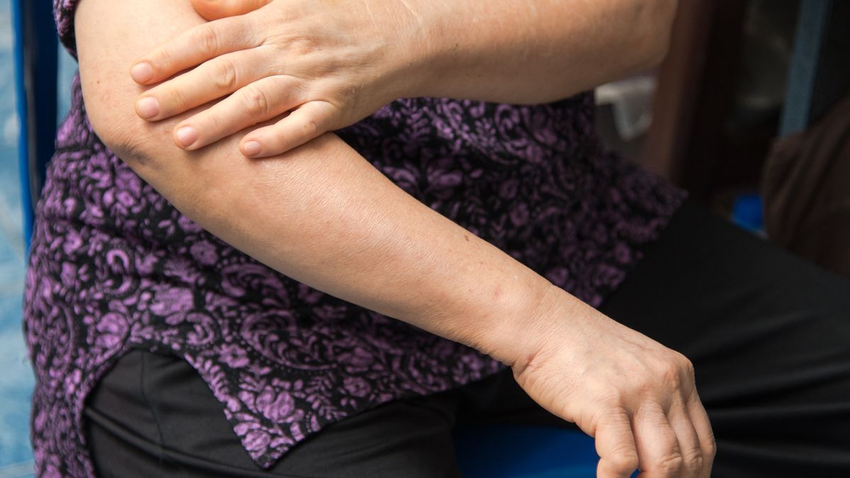 Midsection Of Woman Touching Elbow In Pain
Nattanan Kanchanaprat / EyeEm