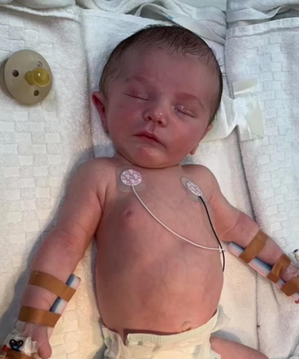 Maluch wypadł z kosza i trafił na oddział intensywnej terapii noworodków