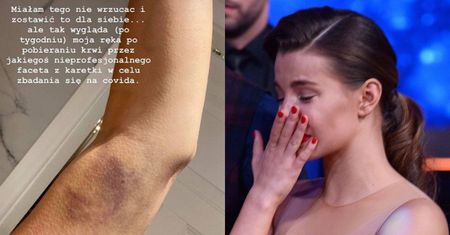 Zdegustowana Julia Wieniawa chwali się SINIAKIEM po teście na koronawirusa: "SUPER, CO?" (FOTO)