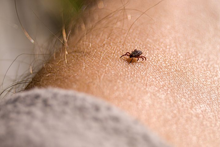 Borelioza to choroba wywołana przez zakażenie, wywołane bakterią Borelia burgdorferi.