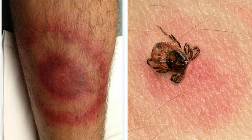 dailymail.co.uk/ 123rf.com