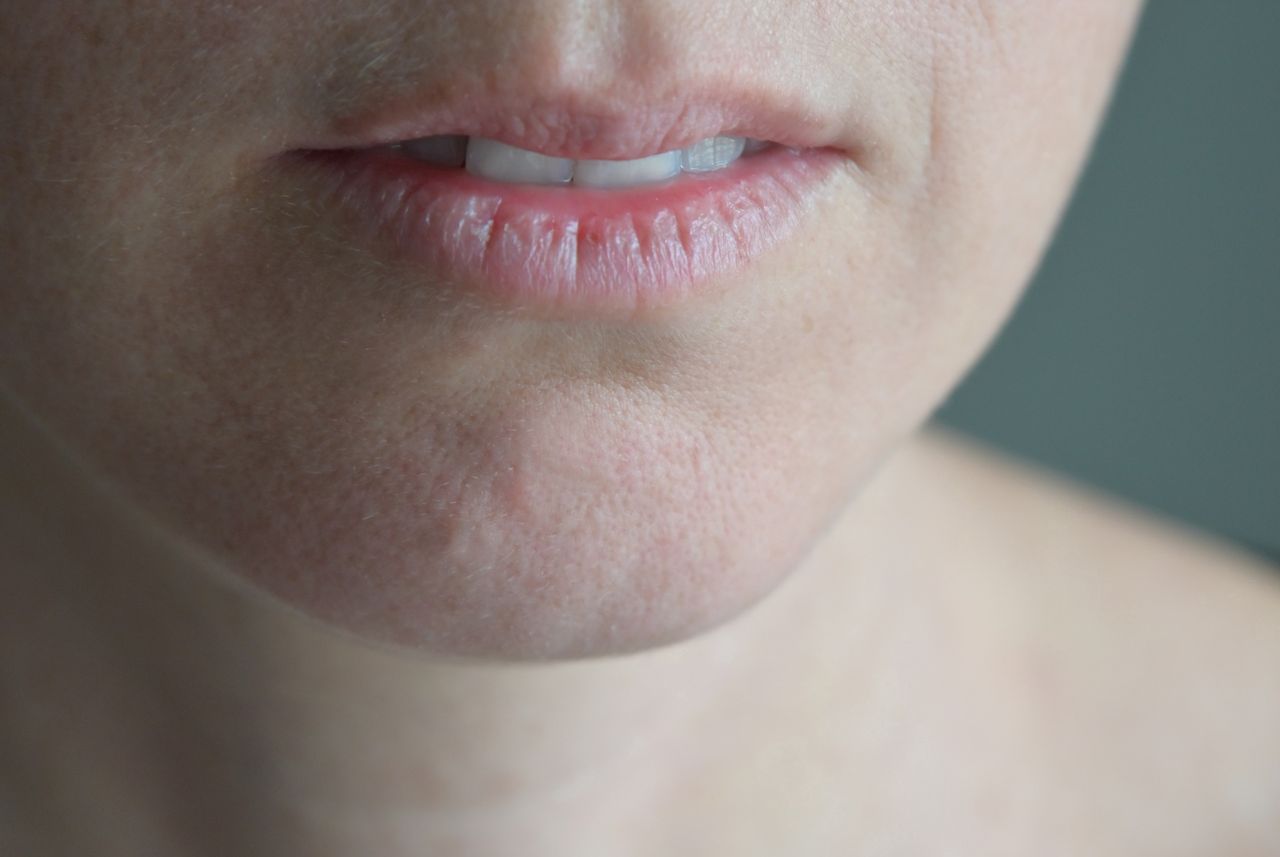 Olive ointment: Winter's affordable skin saviour
