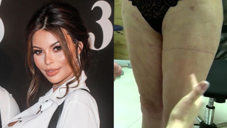 Justyna Gradek broni "lekarza-partacza"