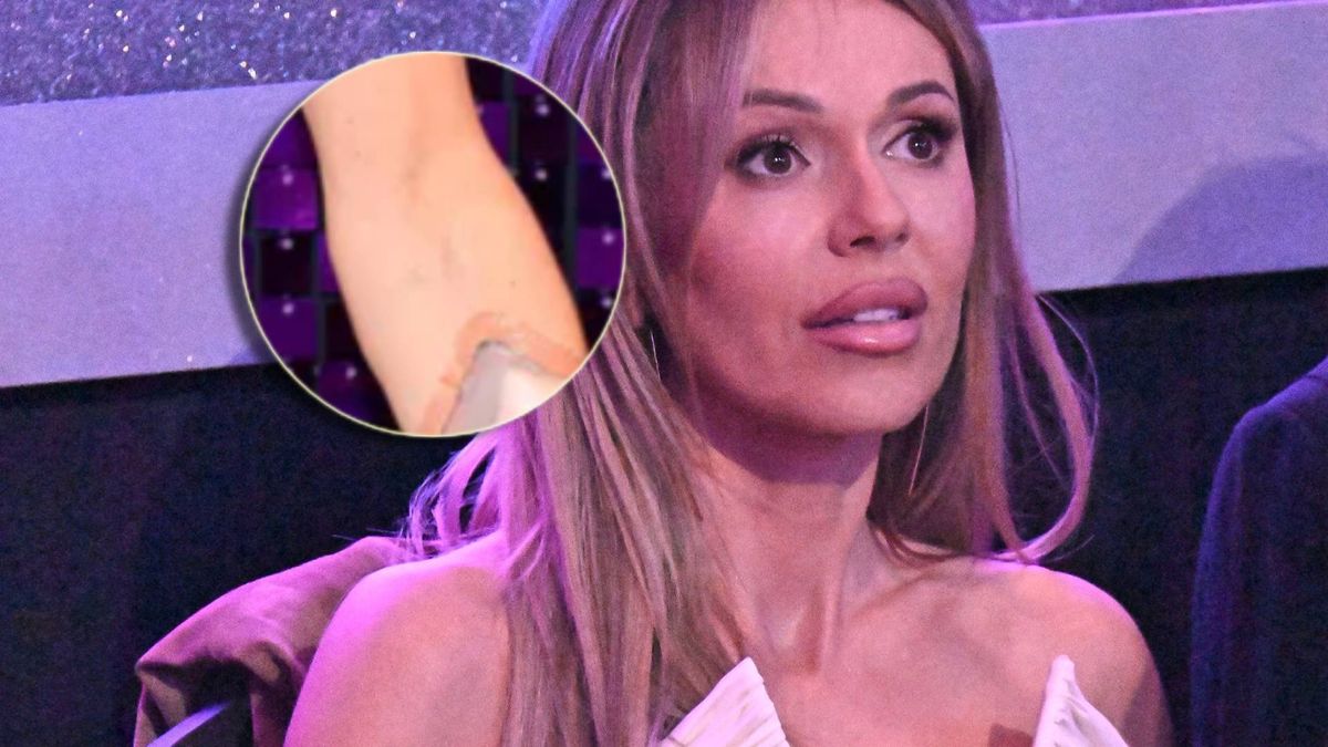 Doda chciała ukryć czerniaka