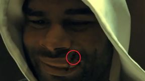 MMA. Alistair Overeem pokazał ranę nad wargą (wideo)