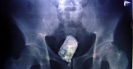 Mężczyzna schował telefon w tyłku, żeby uciec przed policją