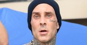 Travis Barker przerywa milczenie po tym, jak trafił do szpitala w KRYTYCZNYM STANIE. Zdradził, jak się czuje
