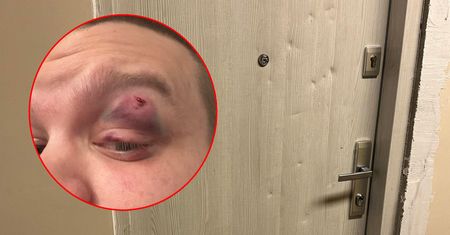 Brytyjczyk pobił Polaka w jego mieszkaniu. Policja wypuściła go na wolność