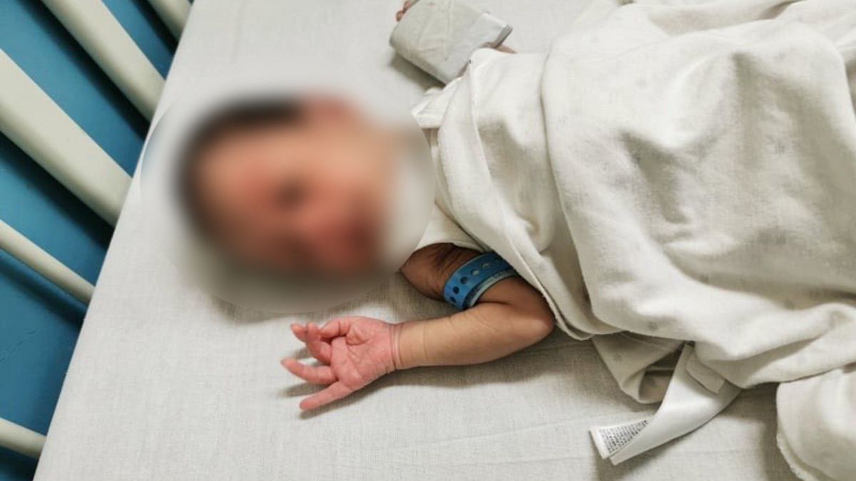 Kobe Manjares został zdiagnozowany pięć dni po narodzinach 