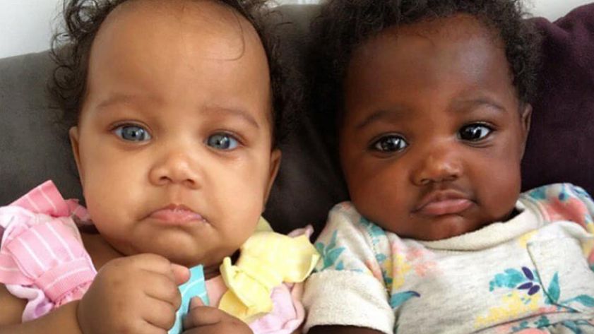 Bliźniaczki o różnym kolorze skóry bardzo się zmieniły