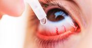 Jak wybrać krople do oczu?