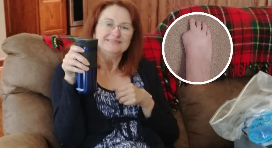 59-latka straciła palca u stopy przez pedicure. Apeluje, by zwracać uwagę na ważną kwestię podczas zabiegu