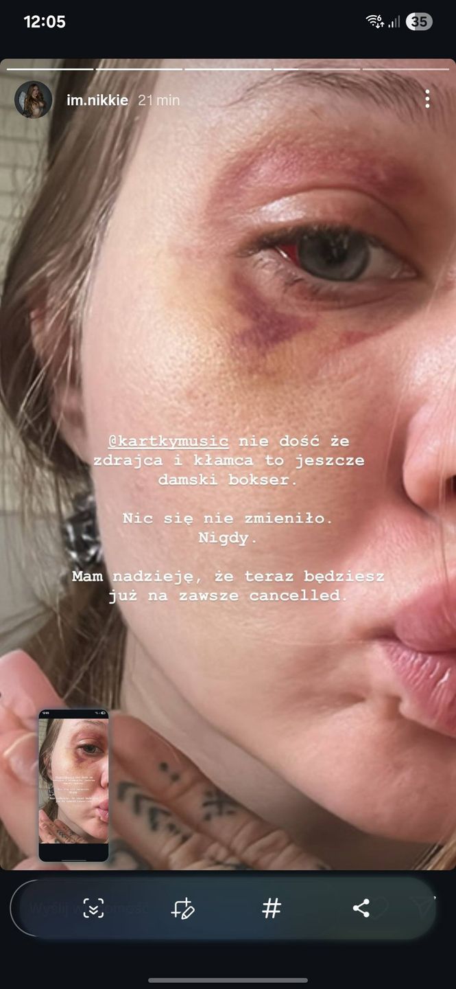 Była dziewczyna oskarża rapera Kartky'ego o przemoc i zdrady