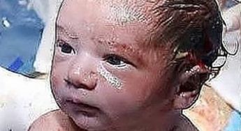 Noworodek otworzył oczy po porodzie. Niesamowite zdjęcie
