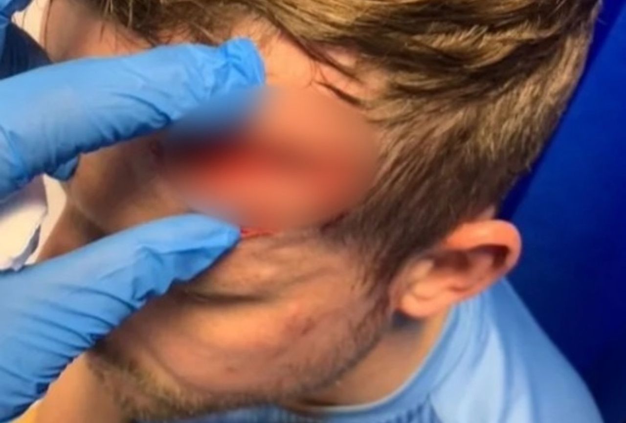 Rywal kopnął go w głowę. Pokazał zdjęcie. Drastyczne!