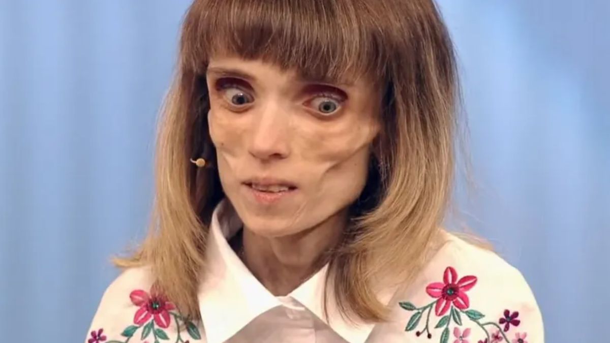 Kristina Karyagina, młoda Rosjanka, której życie zostało zdominowane przez problemy z odżywianiem