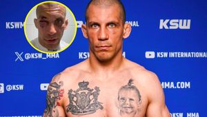Pokazał twarz po walce na KSW. "Muszę sobie zrobić dłuższą przerwę"