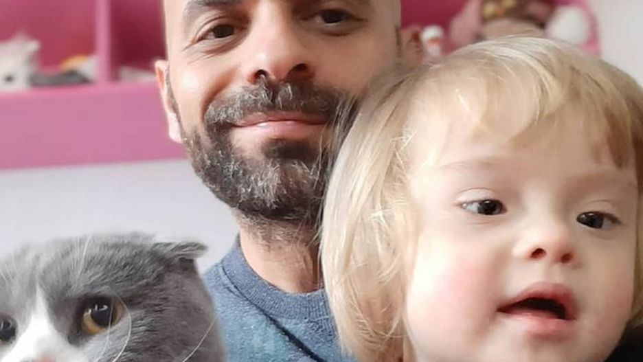 Adoptował dziewczynkę z zespołem Downa. Wcześniej odrzuciło ją 20 rodzin