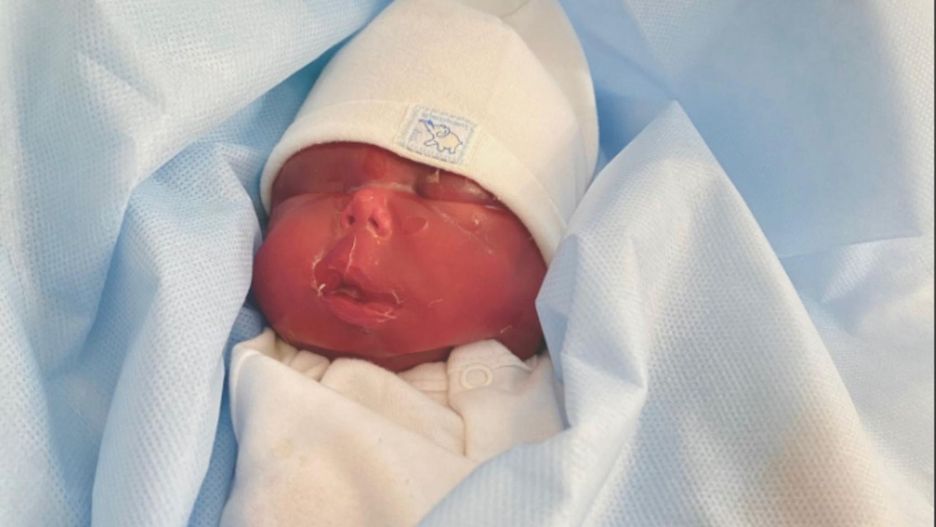 Prezes Ordo Iuris o zmarłym przedwcześnie dziecku: "Umarł, nie czekając na dobry czas"